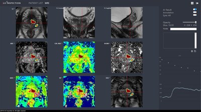 JLK Inspection with AI Technologies at Radiological Society of North America 2018 and International Security Expo 2018