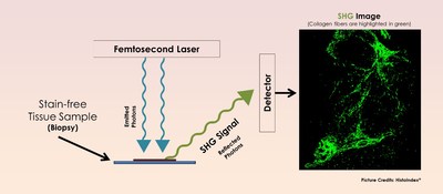 HistoIndex's Second Harmonic Generation (SHG) Technology: A Potentially Important Tool Used In Madrigal's Phase 2 Nonalcoholic Steatohepatitis (NASH) Clinical Trial