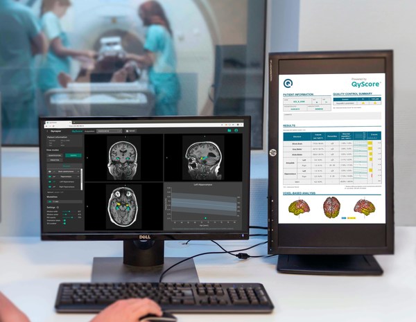 QYNAPSE (France) and TRUE POSITIVE MEDICAL DEVICES (Canada) are partnering to provide the most advanced AI platform for brain diseases