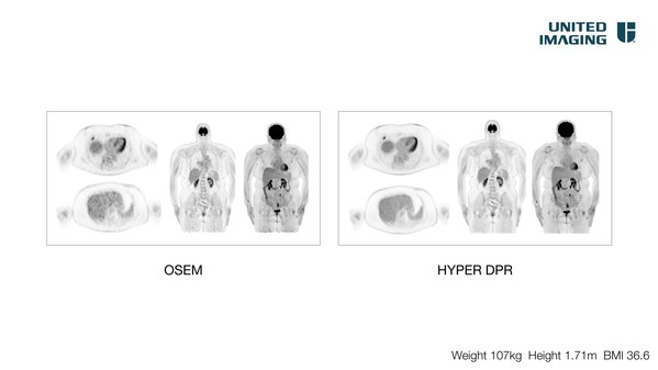 United Imaging Splashes Out at SNMMI 2021 With Clinical and Preclinical Technologies, Total-body AI, and Award-Winning Business Programs