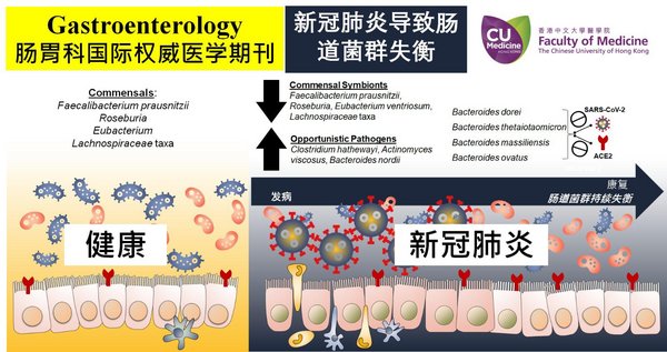 CU Medicine Develops a Probiotic Formula to Target Imbalance in Gut Microbiota in COVID-19