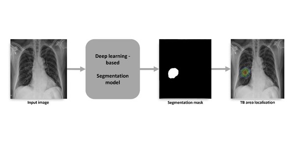 VinBrain and FIT Jointly Release a White Paper on Utilizing Artificial Intelligence in Tuberculosis Screening