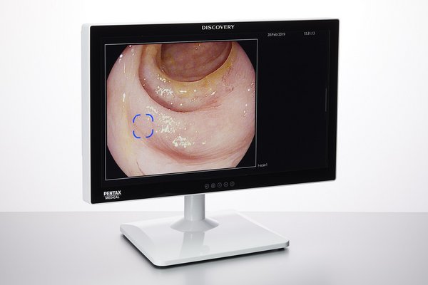 HOYA Group PENTAX Medical Cleared CE Mark for DISCOVERY(TM), an AI Assisted Polyp Detector