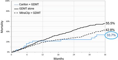 New Data Confirms Cardiac Dimensions' Carillon® System Shows Favorable Long-Term Survival Rate In Patients With Functional Mitral Regurgitation