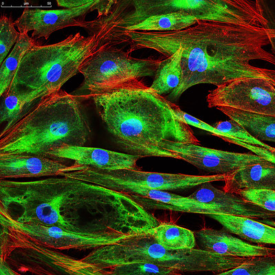 FibroGenesis Announces the Filing of its 200th Patent for Fibroblast Cell Therapy Platform