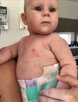 Mum Hails $10 Childs Farm Skincare Products "Life-changing" After They Clear Her Daughter's Severe Eczema