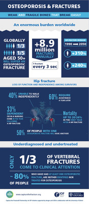 New Capture the Fracture® Partnership Aims for 25% Reduction in the Incidence of Hip and Vertebral Fractures Due to Osteoporosis by 2025