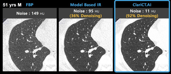 ClariPi to Showcase its AI Medical Imaging Solutions at RSNA 2021