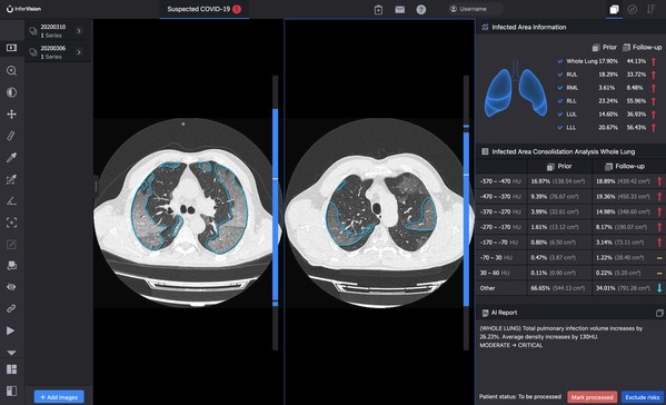 InferVision AI Assists the European Commission Monitoring COVID-19 Variants