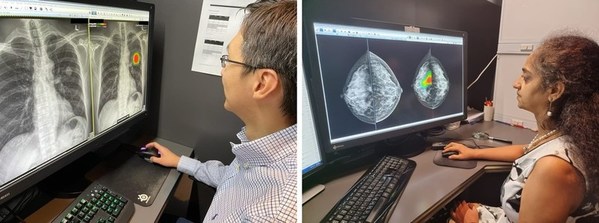 RadLink, Singapore's Leading Imaging Center, Adapts Lunit AI to Analyze Chest X-rays and Mammograms