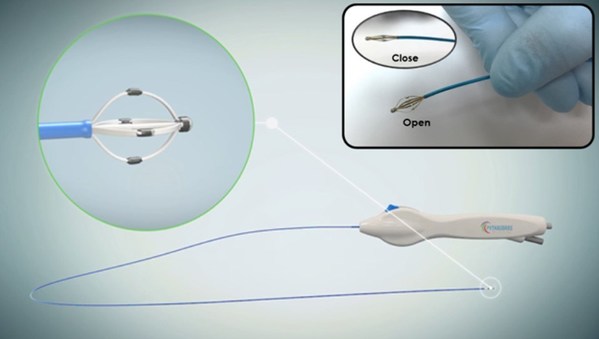 SyMap Medical Ltd. Announces its Strategic Collaboration with Pythagoras Medical