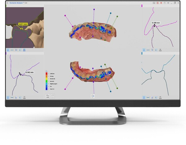 Medit Launches New Occlusion Analyzer App for Quick and Easy Analysis