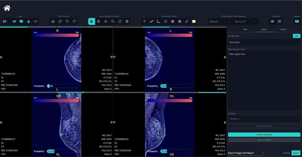 Breast Cancer AI Company FathomX Raises SGD$ 2.24 million in Pre-series A Funding