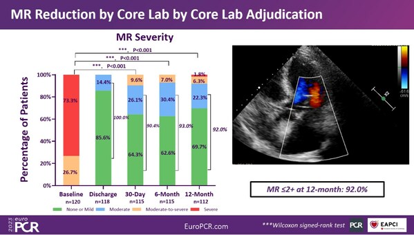 Novel Transcatheter Valve Repair Device: DRAGONFLY-DMR 12-Month Trial Results Revealed at EuroPCR 2023