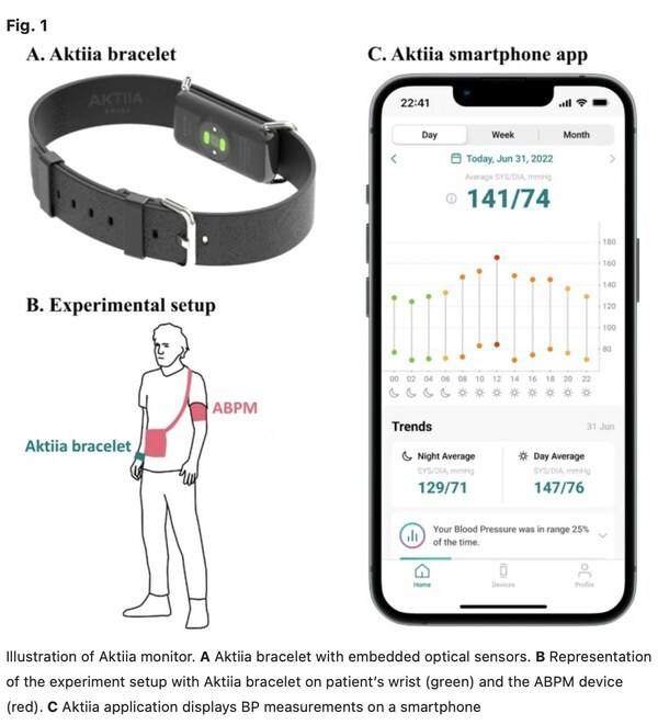 Aktiia's Continual Blood Pressure Solution Shows Comparable Results to ABPM