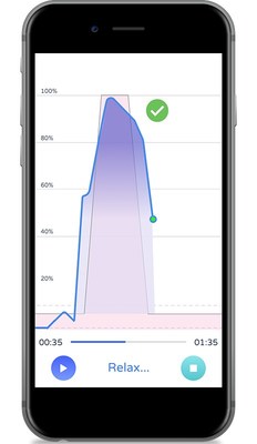 PeriCoach(r) Real-World Data Analysis Reveals Statistically and Clinically Significant Reduction in Incontinence Symptoms Within 3 Weeks