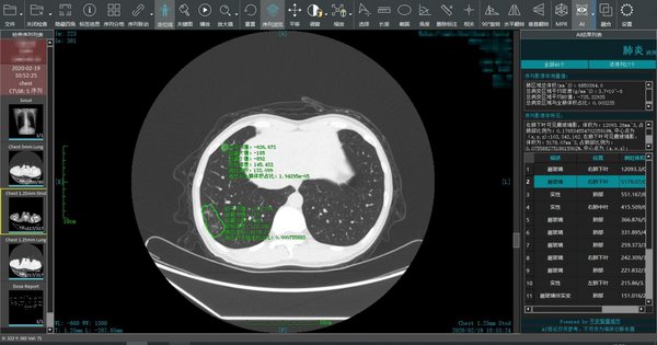 Ping An Launches COVID-19 Smart Image-Reading System to Help Control the Epidemic