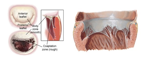 Peijia Medical's New Milestone Asia's first successful clinical case using HighLife transseptal mitral valve replacement technology