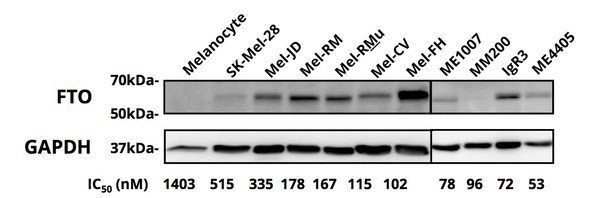 Zantrene® kills melanoma cancer cells that overproduce FTO