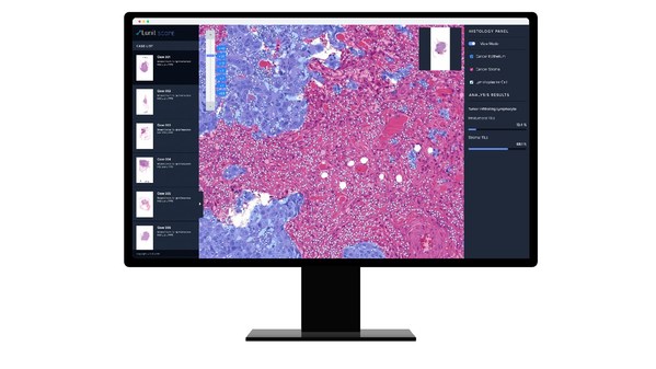 New Immunotherapy Combination Study for Nasopharyngeal Cancer Demonstrates Effectiveness of Lunit AI as Predictive Aid in Treatment Outcome--Published in Clinical Cancer Research