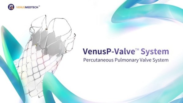 First American Patient Treated with VenusP-Valve™ Under Compassionate Use