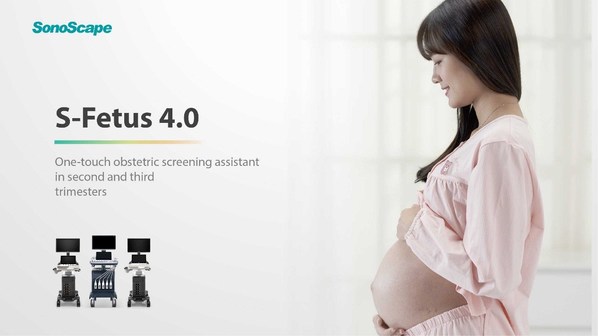 SonoScape S-Fetus 4.0 Release to Simplify Sonography Process