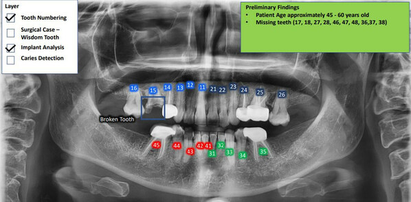 SayHeart Announces AI-Powered Visual-to-Text Transformation Pilot Testing for Dental X-Rays, with Kindlehouse Dentistry Partnership